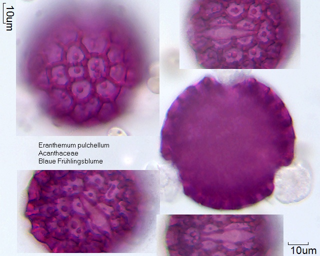 Pollen von Eranthemum pulchellum