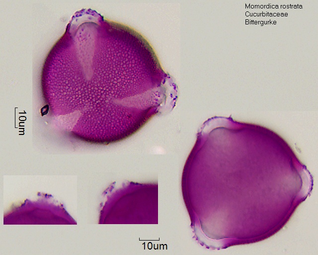 Pollen von Momordica rostrata, 5-019