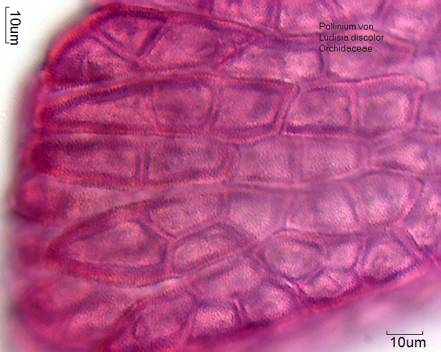 Pollinium mit in Tetraden angeordneten Pollenkörner von Ludisis discolor