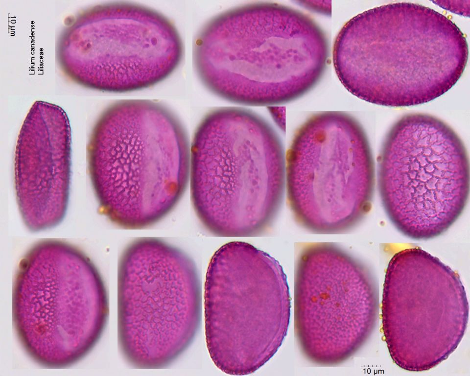 Pollen von Lilium canadense