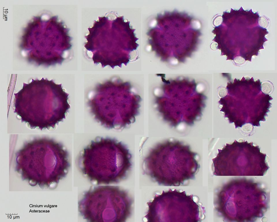 Pollen von Cirsium vulgare