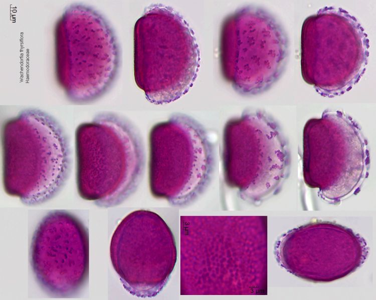 Datei:Wachendorfia thyrsiflora.jpg