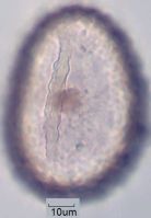 Polypodium vulgare monolet (3).jpg
