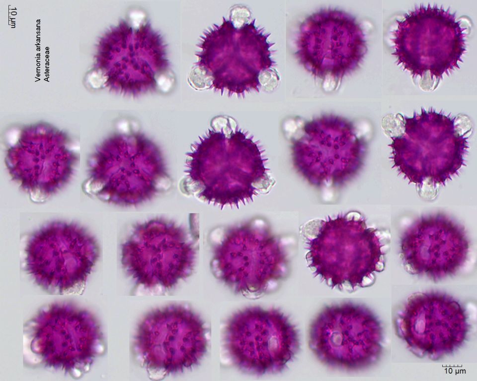 Pollen von Vernonia arkansana