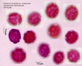 Hieracium aurantiacum (1).jpg