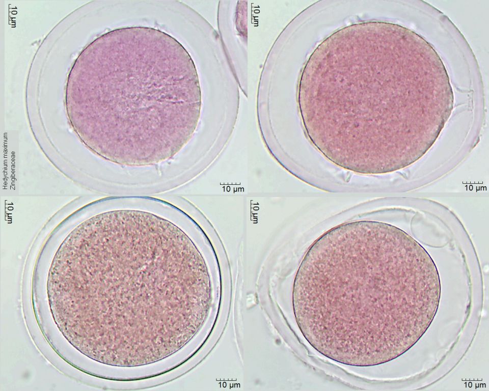 Pollen von Hedychium maximum