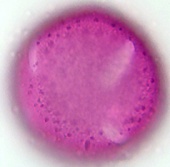 Bestimmungshilfe – Pollen-Wiki