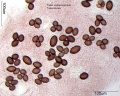 Tuber melanosporum.jpg